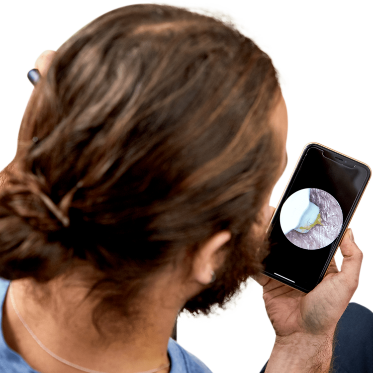 EarShovel™ | Ohrenschmalzentferner